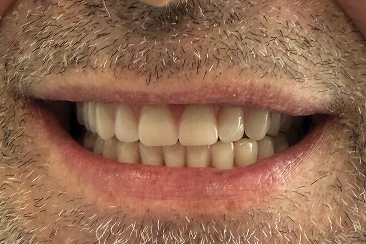 Patient smile after dental treatment