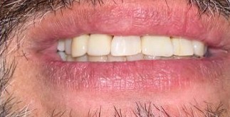 Patient smile after dental treatment