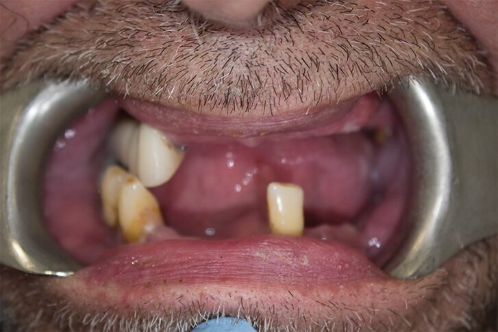 Patient smile before dental treatment